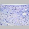 Neuronas Nissl 26.jpg